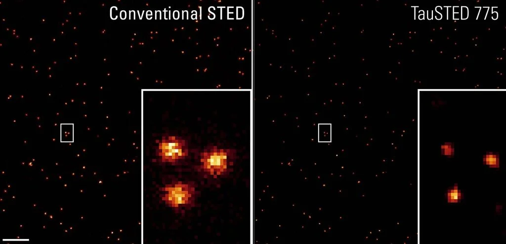 Leica STELLARIS STED & STELLARIS 8 STED 4